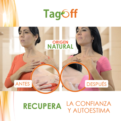 Tag Off – Solución Oleosa de Thuja | Cuidado de la Piel | 15 ml