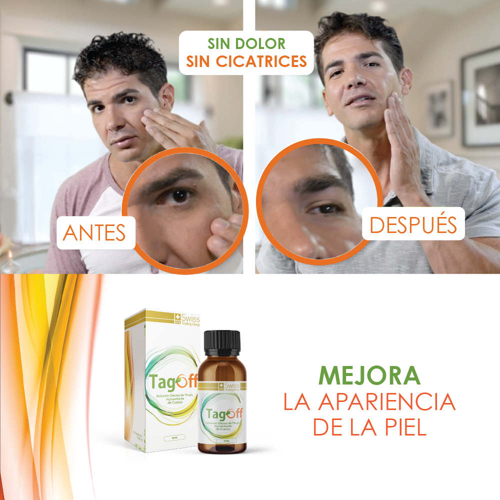 Tag Off – Solución Oleosa de Thuja | Cuidado de la Piel | 15 ml