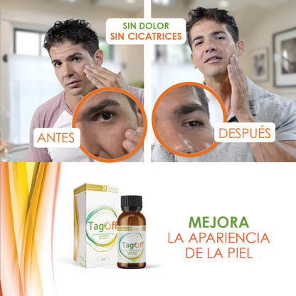 Tag Off – Solución Oleosa de Thuja | Cuidado de la Piel | 15 ml