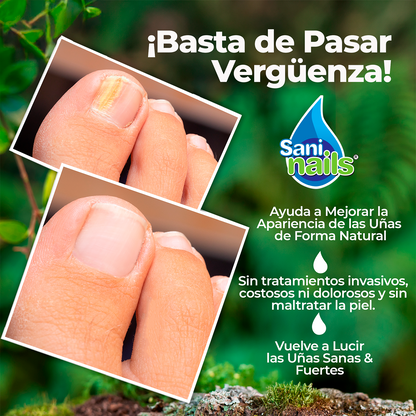 Sani Nails solución oleosa de copaiba 30ml. Tratamiento ideal para fortalecer uñas débiles, hidratar cutículas y mejorar la apariencia de tus manos de forma natural.