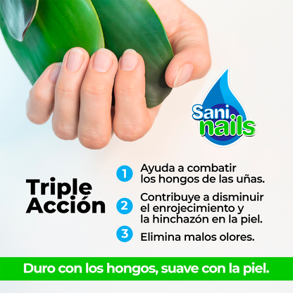 Sani Nails solución oleosa de copaiba 30ml. Tratamiento ideal para fortalecer uñas débiles, hidratar cutículas y mejorar la apariencia de tus manos de forma natural.