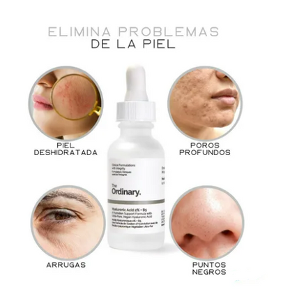The Ordinary Hyaluronic Acid 2% + B5 Serum – Ácido Hialurónico Hidratante Facial